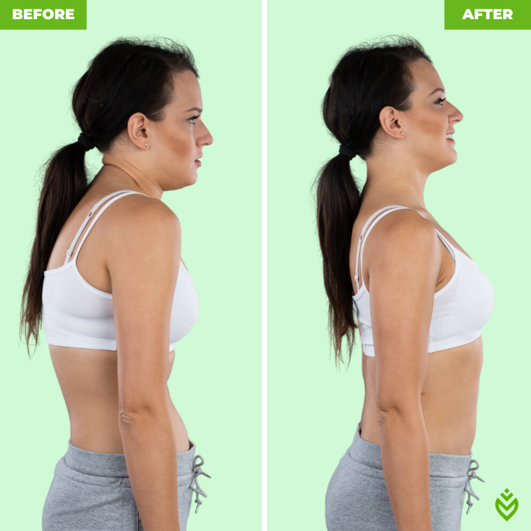 Posture Correction Device™